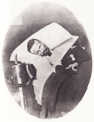 Narciso Bronzerti (1821-1859) ferito a Treponti il 15 giugno 1859